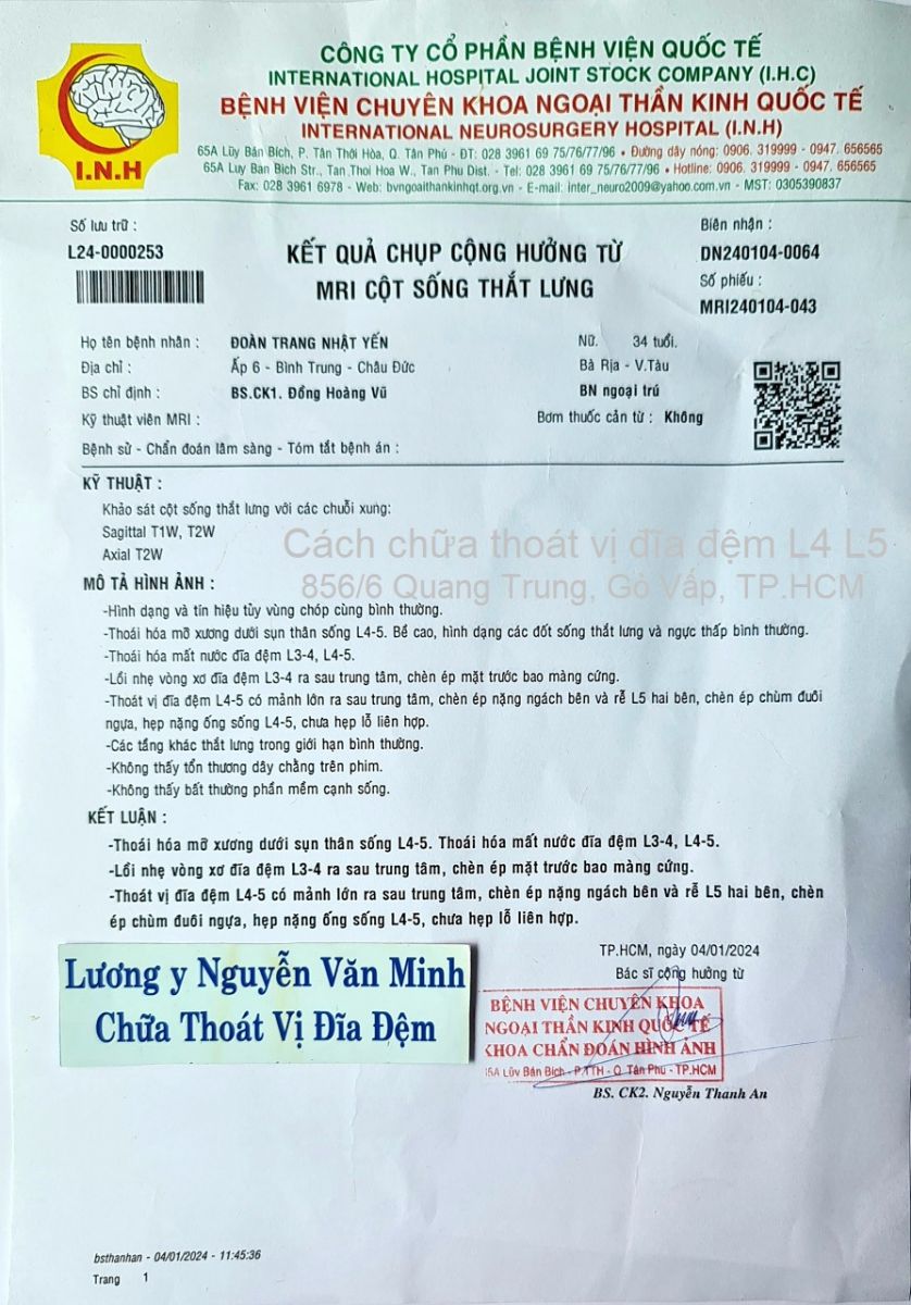 Cách chữa thoát vị đĩa đệm L4 L5